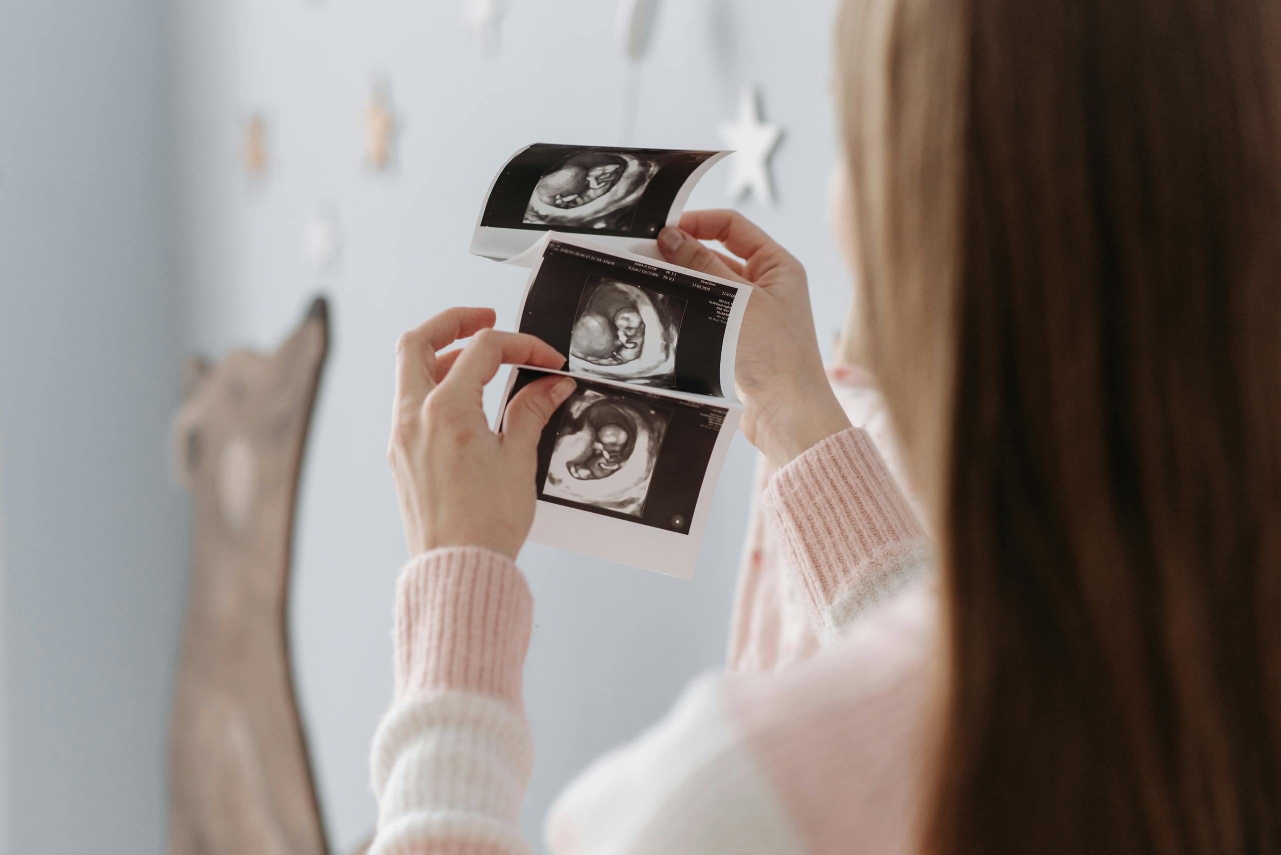 A pregnant woman looks at ultrasound images, showcasing her baby's development. Perfect for healthcare and pregnancy themes.